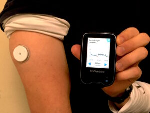 diabetes insulina glucosa freestyle libre sensor